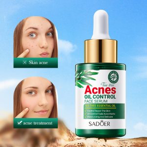 SÉRUM ANTIACNÉ Y CONTROL GRASA CON ÁRBOL DE TÉ 30 ML 42446