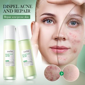 LOCION FACIAL ACIDO SALICILICO ANTIACNE REPARADORA 100ML 011305